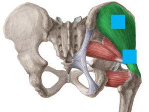 Anatomical drawing of gluteus medius with square blue electrodes at top and bottom of the fan shaped muscle